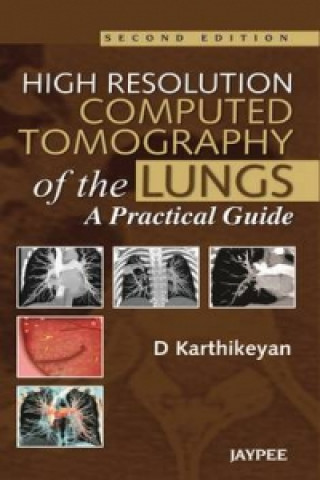Könyv High Resolution Computed Tomography of the Lungs: A Practical Guide D. Karthikeyan