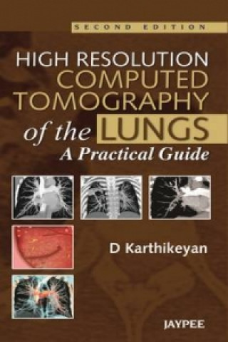 Libro High Resolution Computed Tomography of the Lungs: A Practical Guide D. Karthikeyan