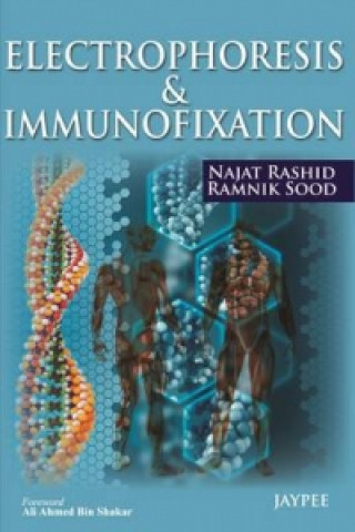 Kniha Electrophoresis & Immunofixation Najat Rashid