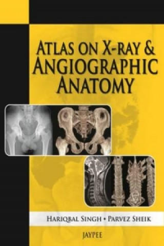 Kniha Atlas on X-Ray and Angiographic Anatomy Hariqbal Singh