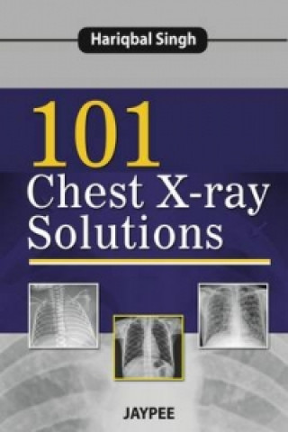 Книга 101 Chest X-Ray Solutions Hariqbal Singh
