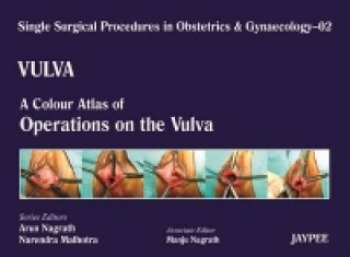 Book Single Surgical Procedures in Obstetrics and Gynaecology - Volume 2 - VULVA - A Colour Atlas of Operations on the Vulva Arun Nagrath