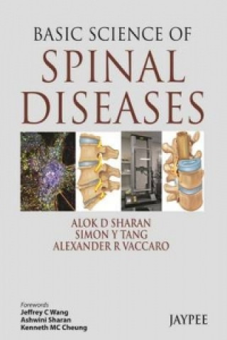 Kniha Basic Science of Spinal Diseases Alok D. Sharan