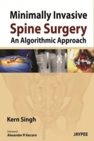 Kniha Minimally Invasive Spine Surgery: An Algorithmic Approach Kern Singh