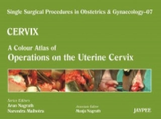 Książka Single Surgical Procedures in Obstetrics and Gynaecology - Volume 7 - CERVIX - A Colour Atlas of Operations on the Uterine Cervix Arun Nagrath