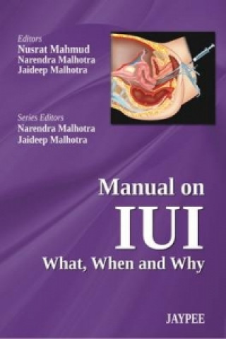 Kniha Manual on IUI: What, When and Why Nusrat Mahmud