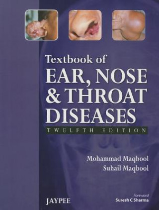 Carte Textbook of Ear, Nose and Throat Diseases Mohammad Maqbool