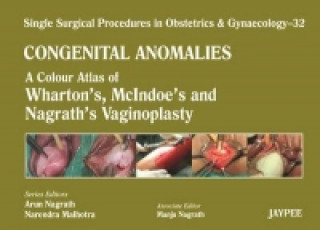 Carte Single Surgical Procedures in Obstetrics and Gynaecology: Volume 32: Congenital Anomalies Arun Nagrath