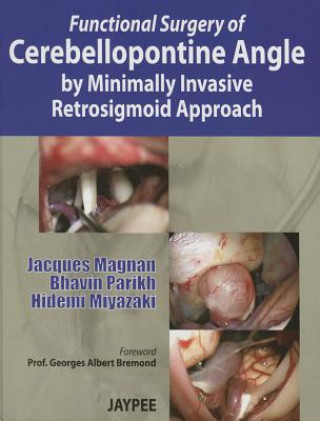 Kniha Functional Surgery of Cerebellopontine Angle by Minimally Invasive Retrosigmoid Approach Jacques Magnan