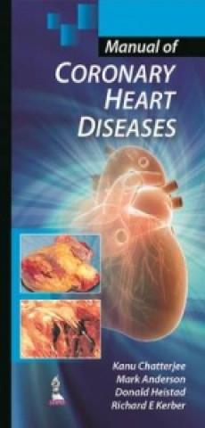 Kniha Manual of Coronary Heart Diseases Donald Heistad