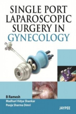 Livre Single Port Laparoscopic Surgery in Gynecology B. Ramesh