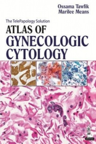 Könyv Atlas of Gynecologic Cytology Ossama Tawfik