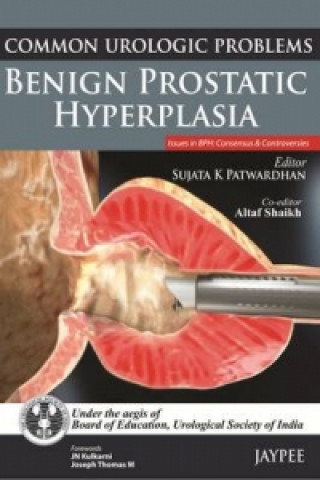 Книга Common Urologic Problems: Benign Prostatic Hyperplasia Sujata Patwardhan