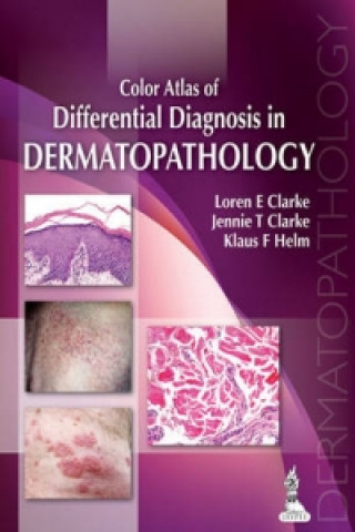 Carte Color Atlas of Differential Diagnosis in Dermatopathology Loren E Clarke