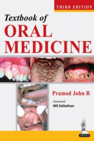Kniha Textbook of Oral Medicine Anil Govindrao Ghom