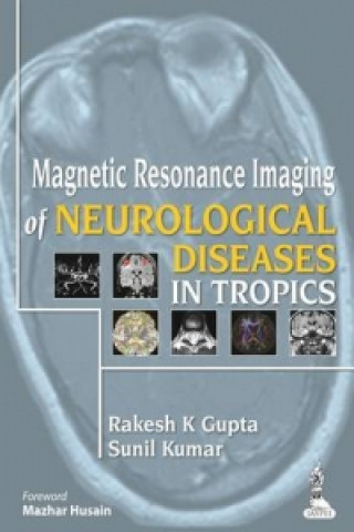 Book Magnetic Resonance Imaging of Neurological Diseases in Tropics 