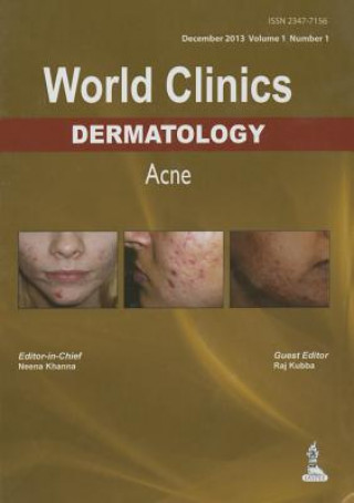 Książka World Clinics: Dermatology - Acne Neena Khanna