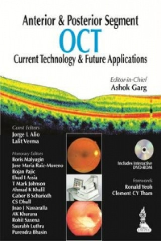 Carte Anterior & Posterior Segment OCT: Current Technology & Future Applications Ashok Garg