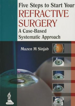 Książka Five Steps to Start Your Refractive Surgery Mazen M. Sinjab