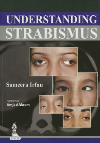 Kniha Understanding Strabismus Sameera Irfan