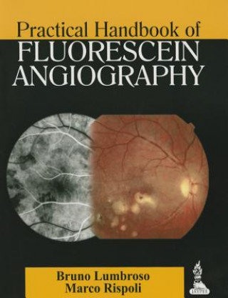 Könyv Practical Handbook of Fluorescein Angiography Bruno Lumbroso