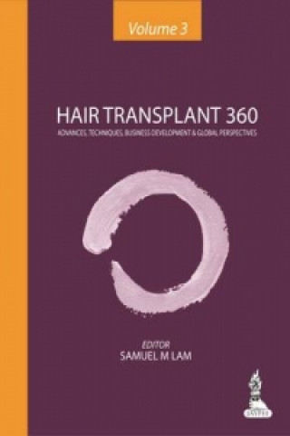 Kniha Hair Transplant 360 - Volume 3 Samuel M. Lam