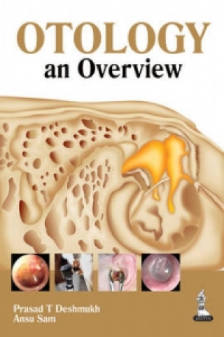 Kniha Otology: an Overview Prasad T Deshmukh