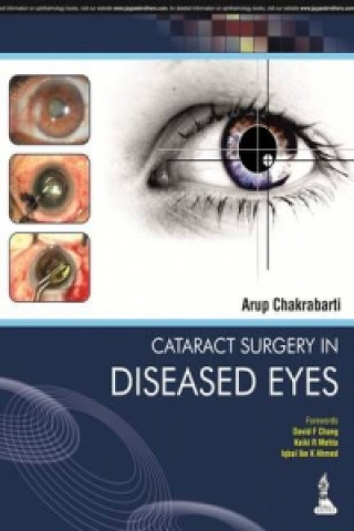 Knjiga Cataract Surgery in Diseased Eyes Arup Chakrabarti