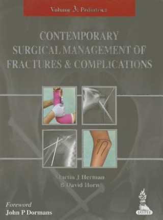 Könyv Contemporary Surgical Management of  Fractures and Complications Martin J. Herman
