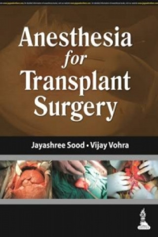 Buch Anesthesia for Transplant Surgery Jayashree Sood