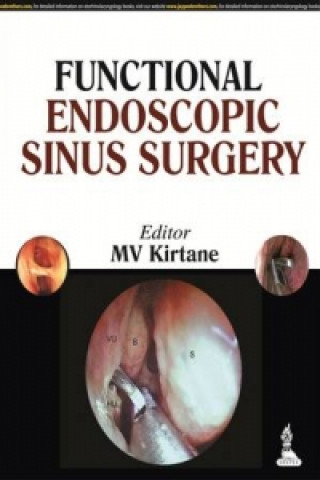 Könyv Endoscopic Endonasal Surgery M. V. Kirtane