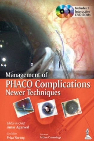 Carte Management of Phaco Complications Amar Agarwal