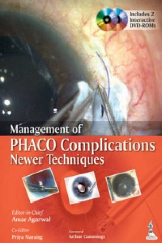 Książka Management of Phaco Complications Amar Agarwal