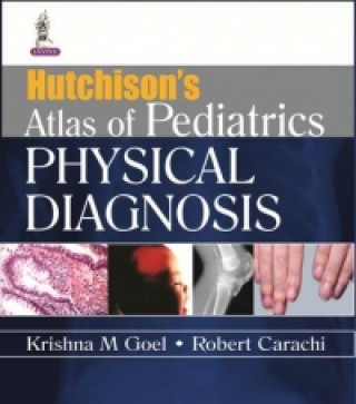 Kniha Hutchison's Atlas of Pediatric Physical Diagnosis Robert Carachi