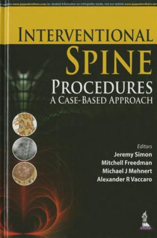 Carte Interventional Spine Procedures Michael J. Mehnert