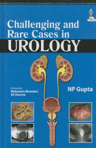 Carte Challenging and Rare Cases in Urology N. P. Gupta