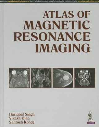 Knjiga Atlas of Magnetic Resonance Imaging Hariqbal Singh