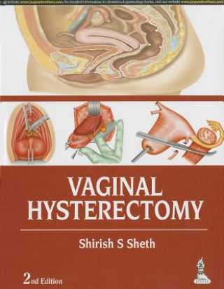 Kniha Vaginal Hysterectomy Shirish S. Sheth