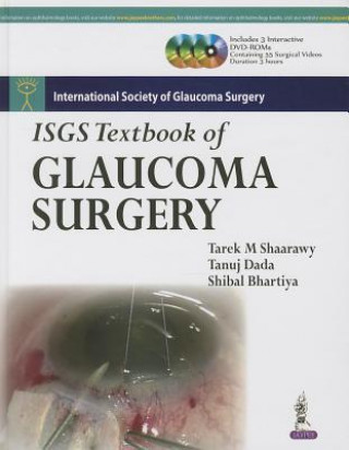 Knjiga ISGS Textbook of Glaucoma Surgery Shibal Bhartiya