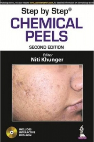 Könyv Step by Step: Chemical Peels Niti Khunger