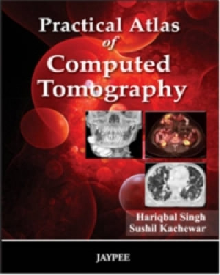 Kniha Practical Atlas of Computed Tomography Hariqbal Singh