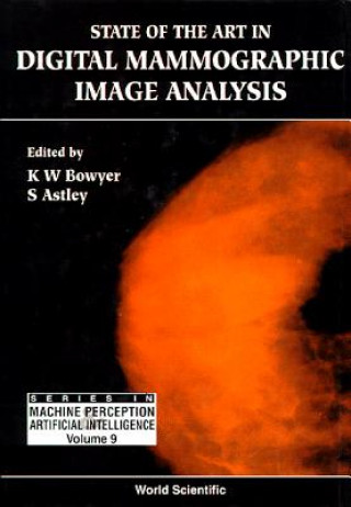 Книга State Of The Art In Digital Mammographic Image Analysis 