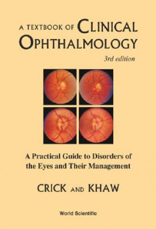 Carte Textbook of Clinical Ophthalmology R.Pitts Crick