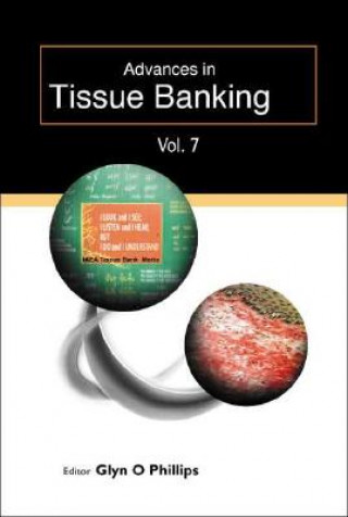 Kniha Advances In Tissue Banking, Vol. 7 Phillips Glyn O