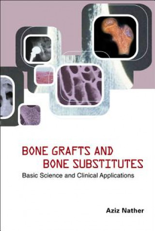 Kniha Bone Grafts And Bone Substitutes: Basic Science And Clinical Applications Nather Abdul Aziz