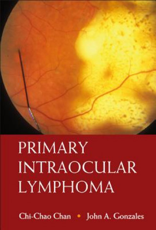 Book Primary Intraocular Lymphoma Chi-Chao Chan