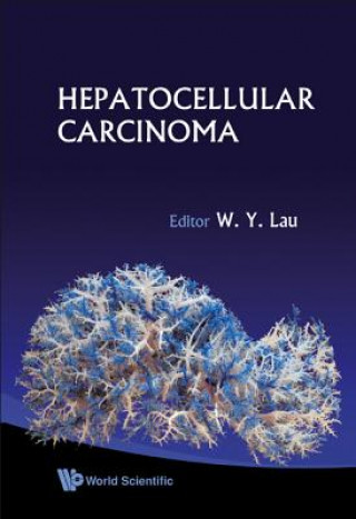 Książka Hepatocellular Carcinoma W. Y. Lau