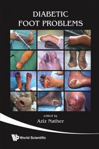Kniha Diabetic Foot Problems Nather Abdul Aziz