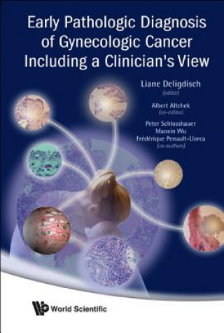 Книга Early Pathologic Diagnosis Of Gynecologic Cancer Including A Clinician's View Liane Deligdisch