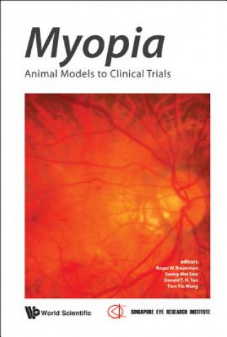 Carte Myopia: Animal Models To Clinical Trials Roger W Beuerman